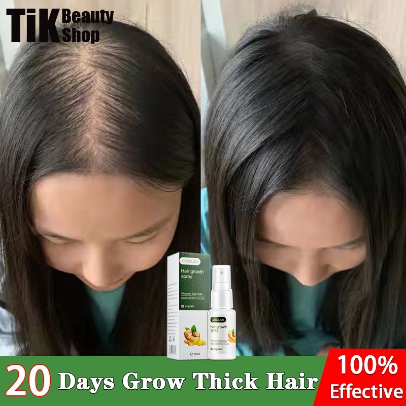 CAIZILAN Hair Growth Spray Serum Fast Hair Growth Spray Hair & Scalp