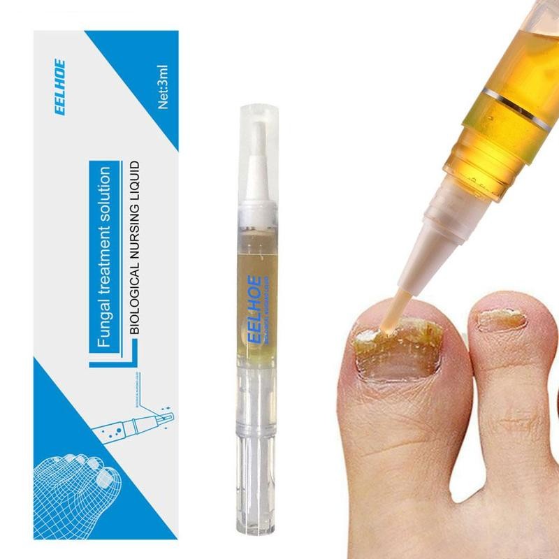 Fungal Nail Liquid Treatment Pen Onychomycosis Paronychia Anti Fungal