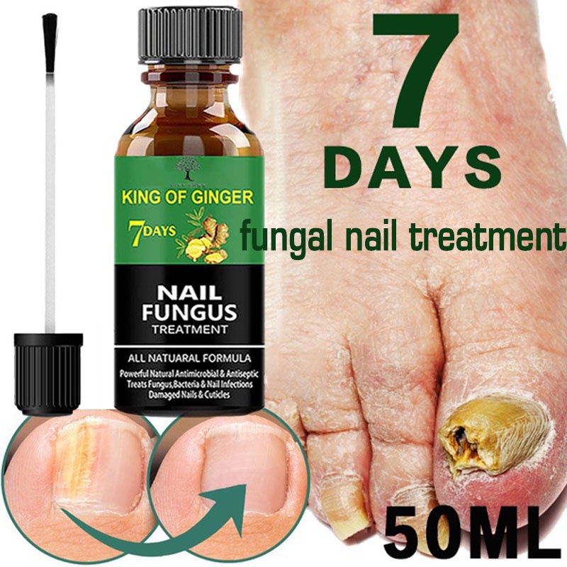 Best Nail Repair, Effective Nail and Pedicure Solutions To Repair and