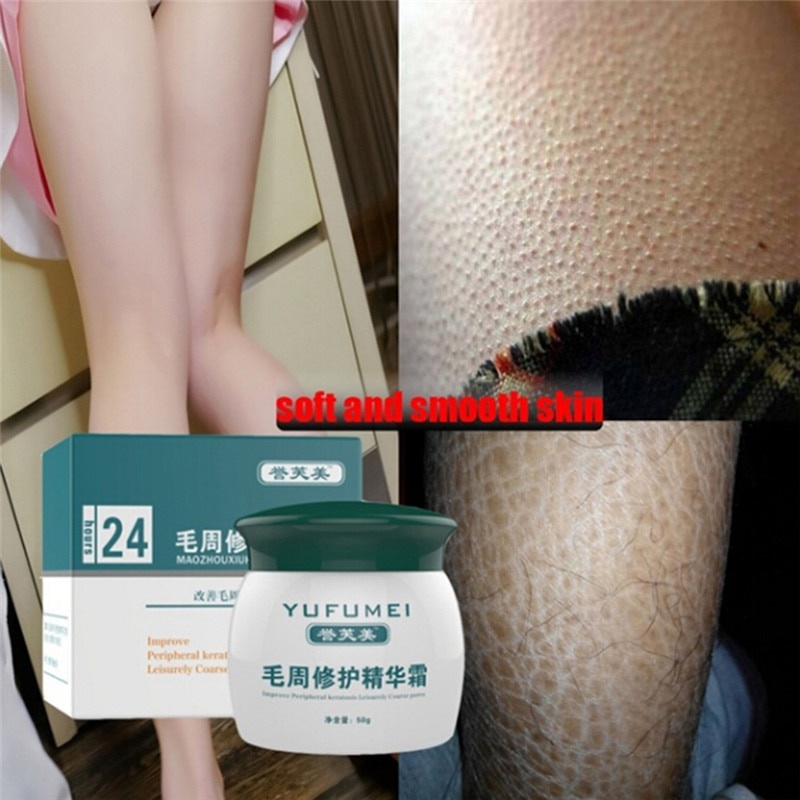 50g Keratosis Pilaris Cream Body Lotion Skin Repair Cream Skin Care Essence Moisturizing And