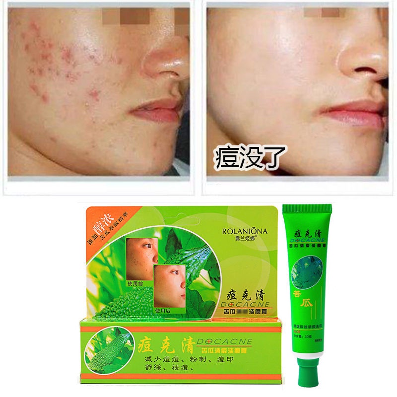 Acne Cream Pimples Skincare Lulan Jina Clearing Bitter Gourd Control