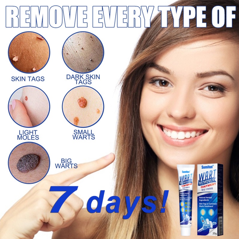 30g Sumifun Painless Warts Remover Cream Medical Foot Ointment