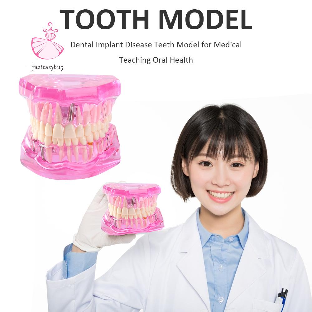 Fashion Dental Orthodontic Model Resin Oral Teeth Model for Oral Health