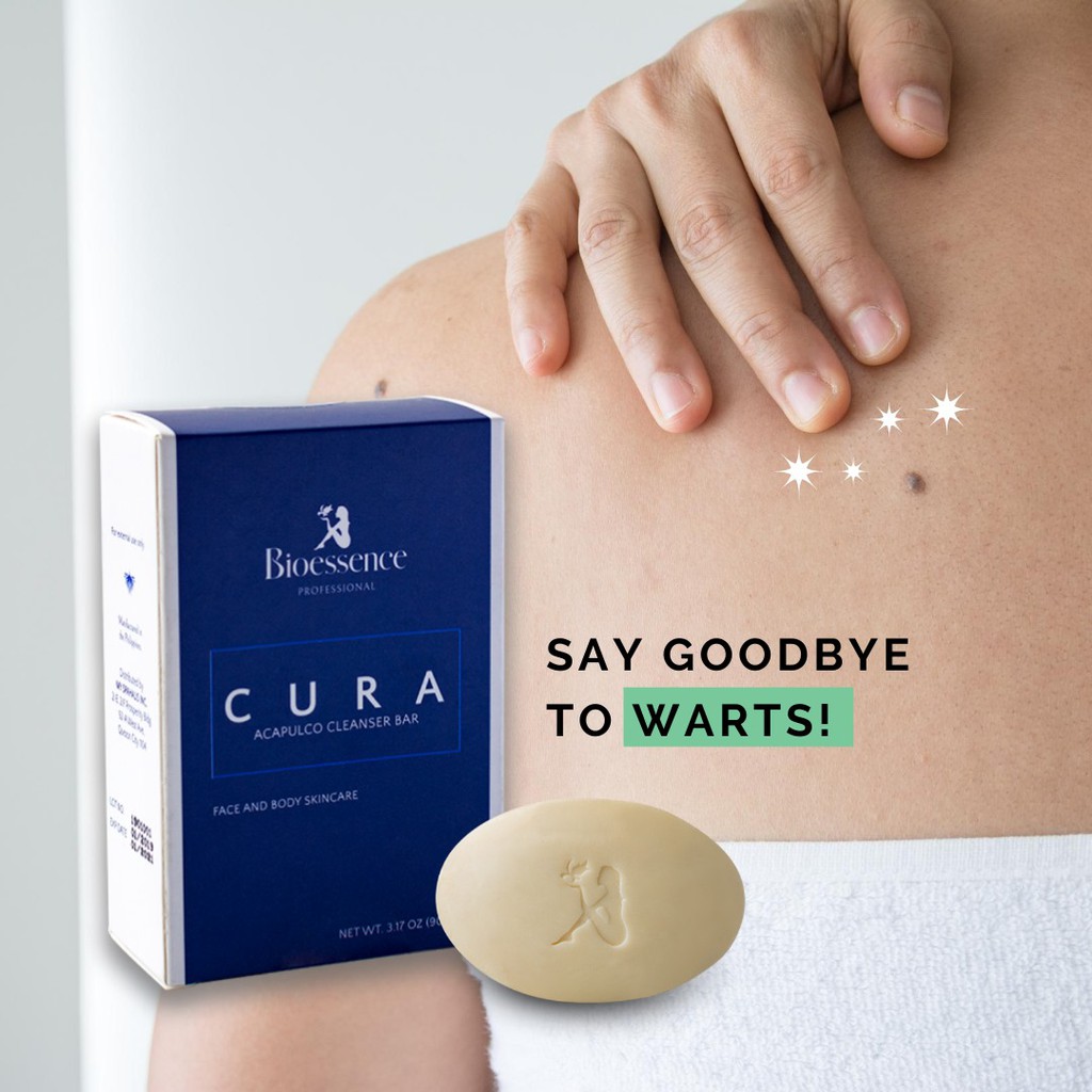 BIOESSENCE CURA ANTI WARTS SOAP Shopee Philippines