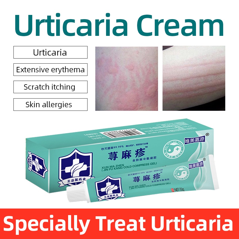 2022 Herbal Medicine Urticaria Ointment Treatment Skin Dermatitis