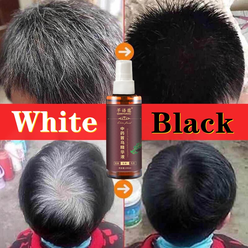 Black Hair Spray Herbal Natural Polygonum Multiflorum Hair Growth