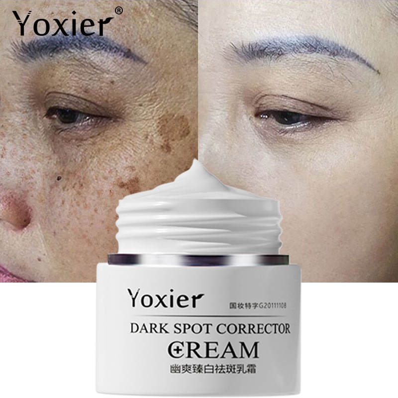 Yoxier Dark Spot Removal Cream Freckle Cream Dark Spots Corrector Fade