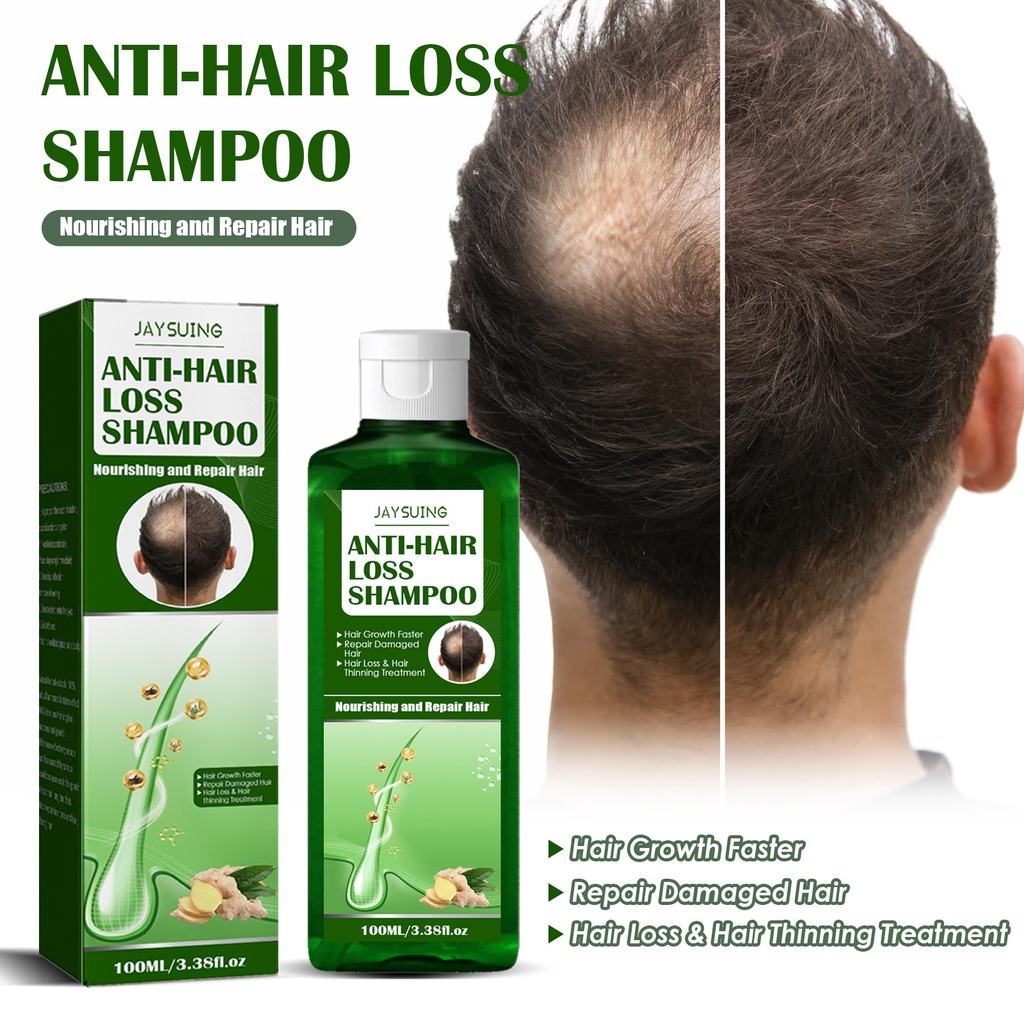 Jaysuing Ginger Shampoo Ginger Hair Growth Anti Thinning/Hair Loss Anti