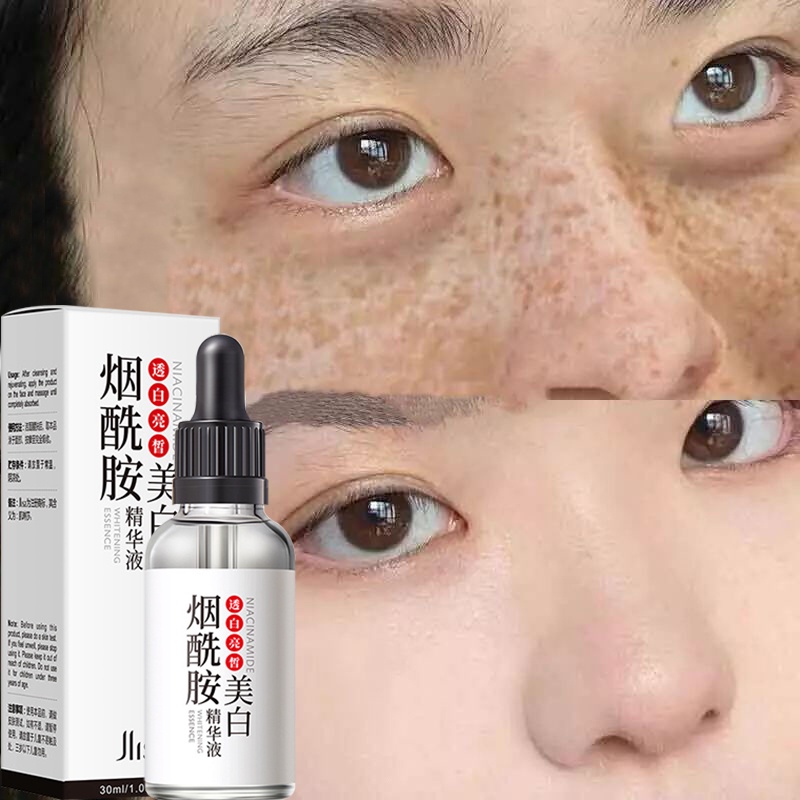 Freckles Remover Whitening Serum Remove Melasma Remove Dark Spots Melanin Melasma Remover 30ml