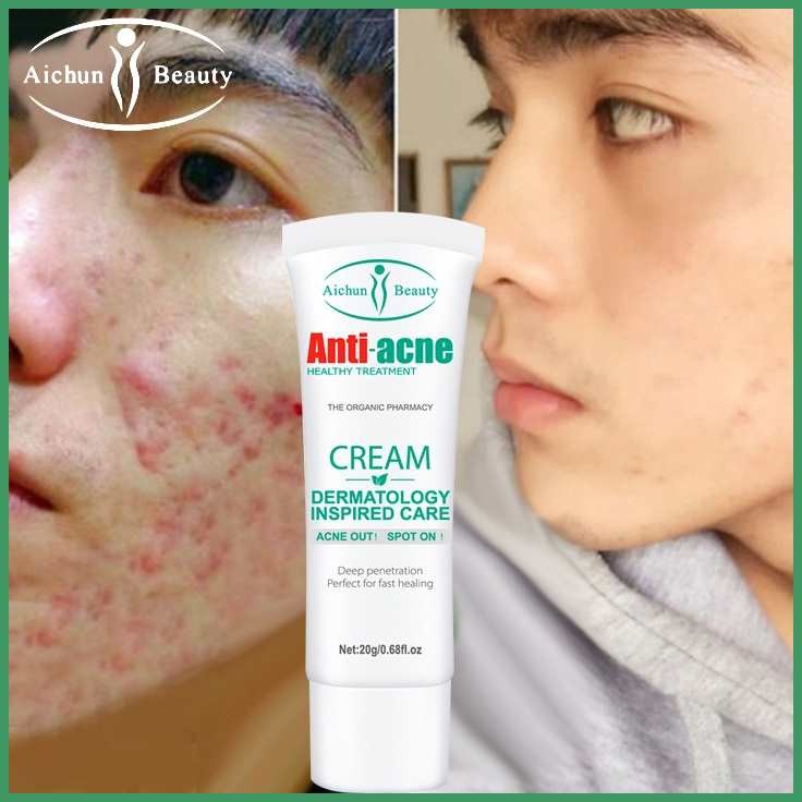 Acne.mS{PimplevD[marks/El>remover>T)cream>I}Anti)L>dark}W)spots>gM