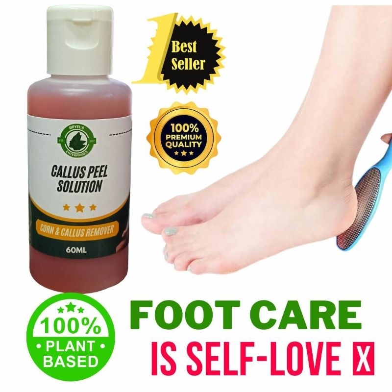 Callus Set Remover/Callus Peel Remover/Pantanggal Kalyo/Callus Peel