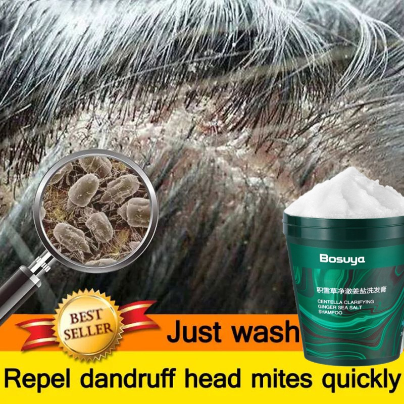 Sea Salt Shampoo Anti Dandruff Ginger Shampoo Psoriasis Removal Shampoo