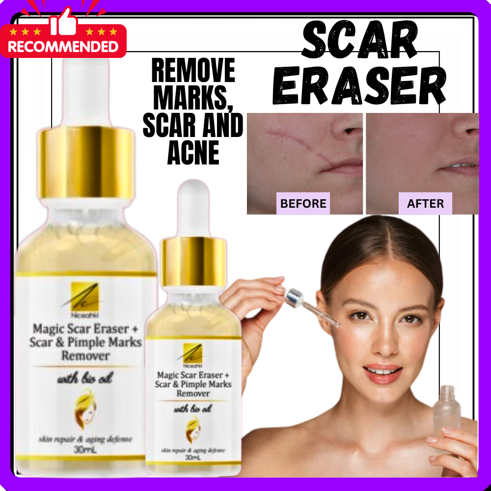 Magic Scar erase, scar remover, scar stretch mark remover cream Proven