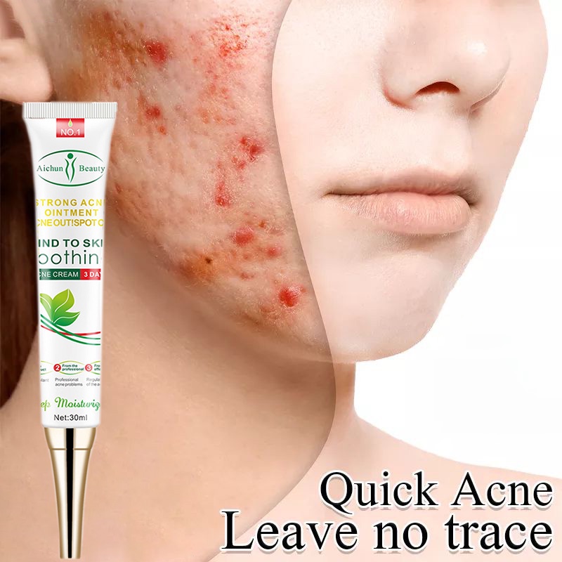 Acne cream pimple eraser pimple marks remover Pore Control Exfoliating