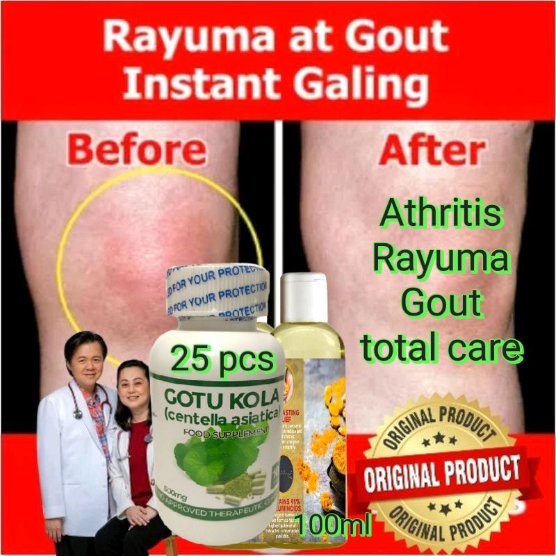 Rayuma Athritis Gout fighter TURMERIC essential Oil Shopee Philippines