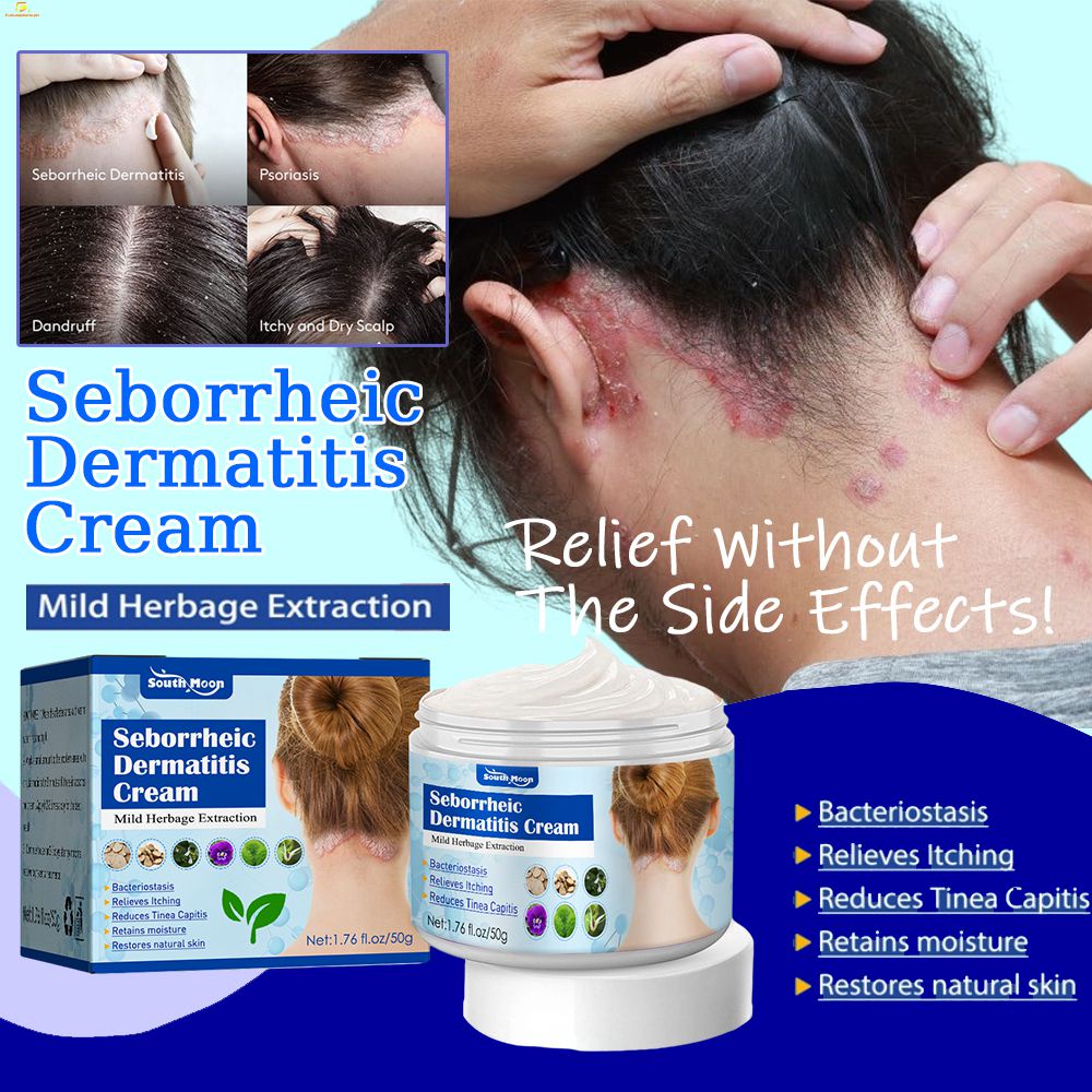 Seborrheic Dermatitis Cream Psoriasis Eczema Antifungal Cream Head Acne