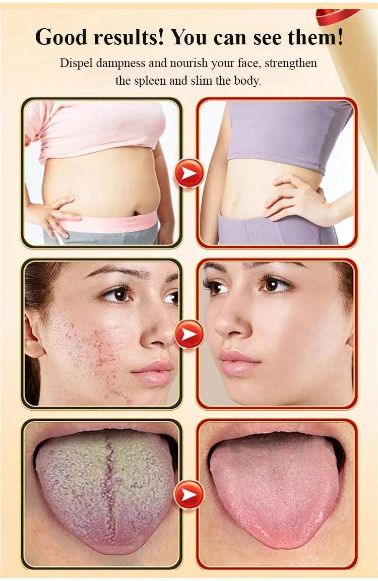 Fat Burning And Slimming Red Bean, Coix Seed, And Fruit Tea