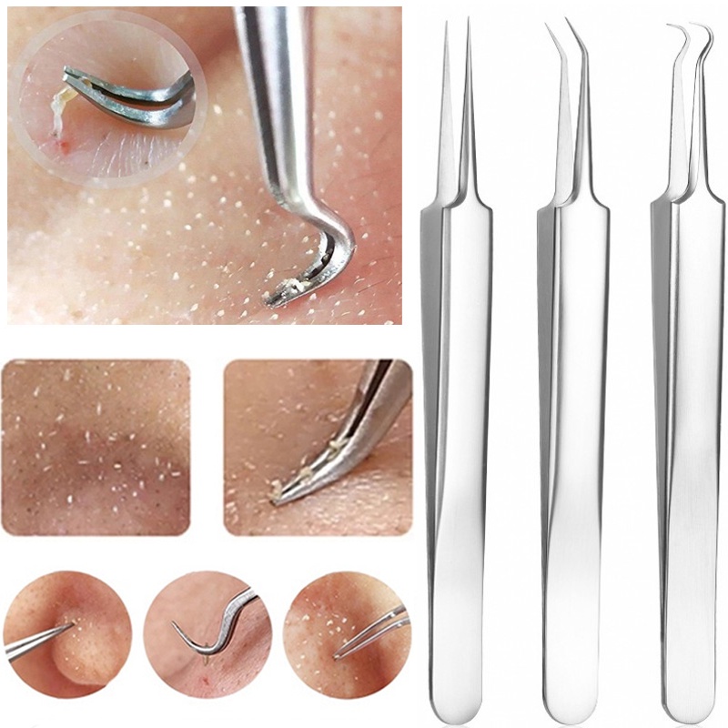 Stainless Steel Acne Needle Tweezers Blackhead Blemish Pimples Removal