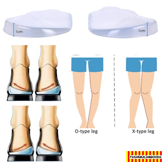 Arch Support Shoe Inserts for O/X Type Leg Corrective Foot Alignment