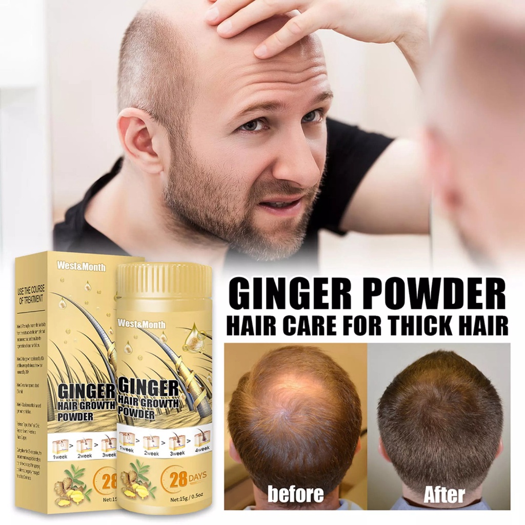 [🔥 New Special Promo! 🇸🇬 Stock]Ginger Hair Growth Powder Natural Oil