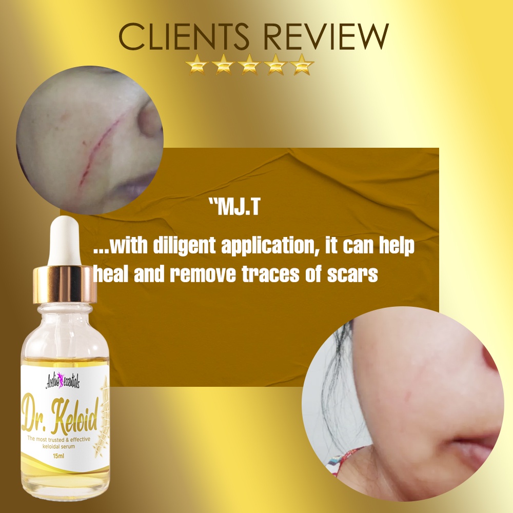 DR.KELOID Original Keloid / Scar Remover 30ml ( old scar / keloid
