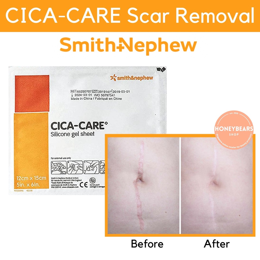 CICACARE SelfAdhesive Silicone Gel Sheet Hypertrophic/Keloid Scar