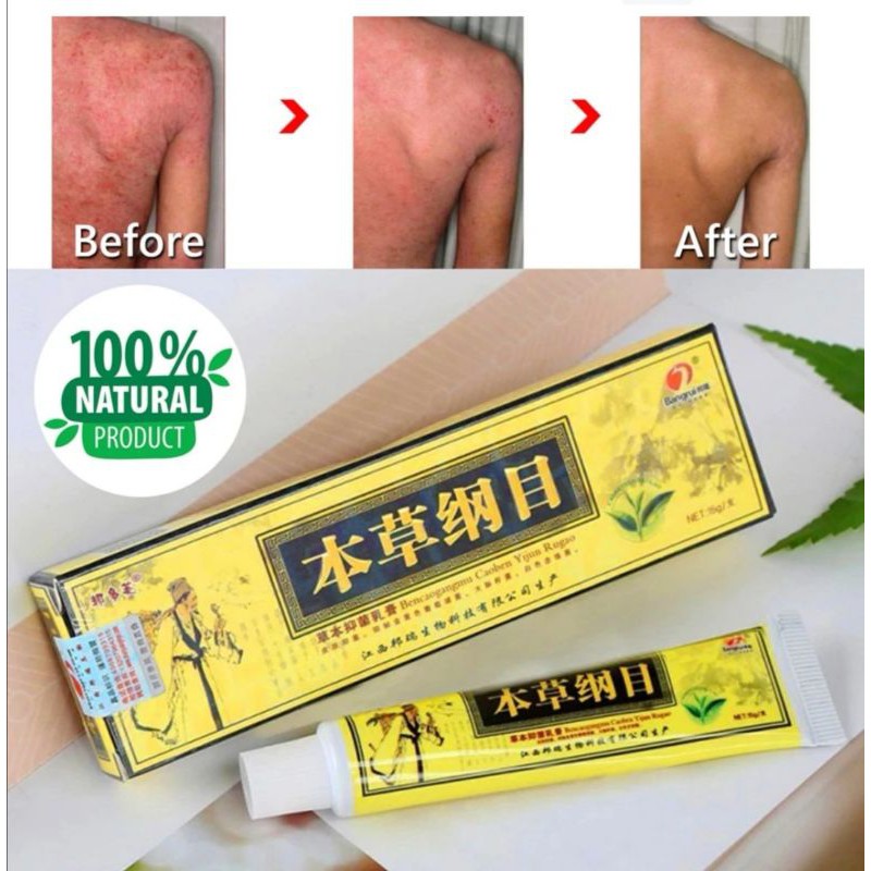 ECZEMA CREAM FROM SMILES AND JOYS HQ ORI ( SG ORIGINAL INSTOCKS