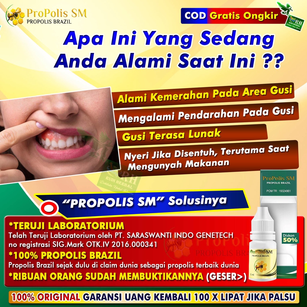 SM Dental & Gum Disease Medicine, Swelling Gum, Bleeding Gum, Lumps In