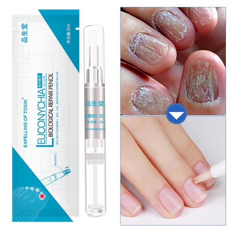 Nail Fungus Treatment Nail Oil Pen Anti Fungal Nail Infection Cuticle
