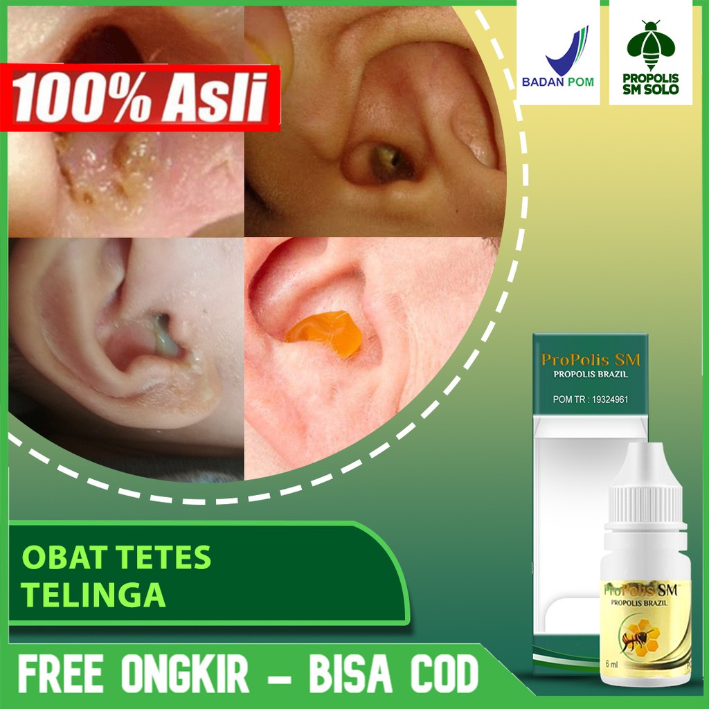 Congek Ear Drops, Watery Ears, Ear Pains, Buzzing PROPOLIS SM In SOLO