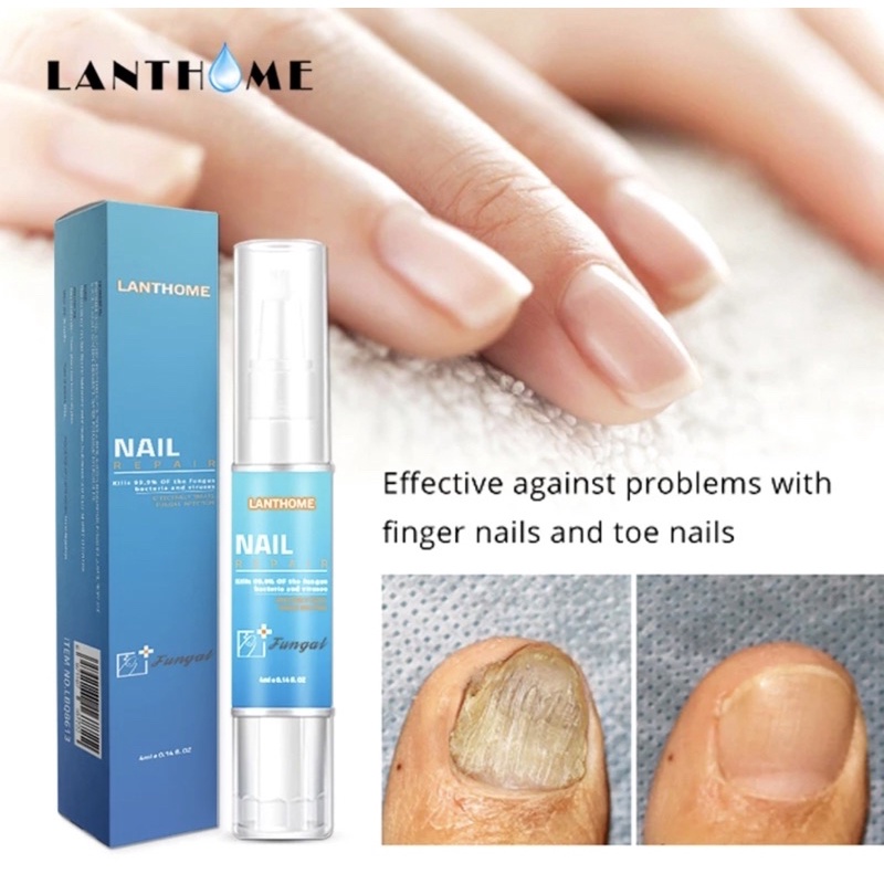 LANTHOME Fungal Nail Treatment Effective Repair Pen for Onychomycosis