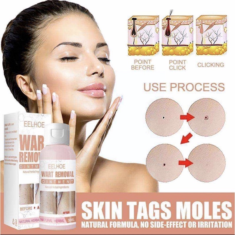 Skin Tag Warts Remover Serum Skin Mole Remover Dark Spot Remover
