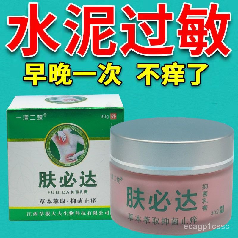 Spot eczema cream Tinea of Feet and Hands Beriberi Cement Allergy