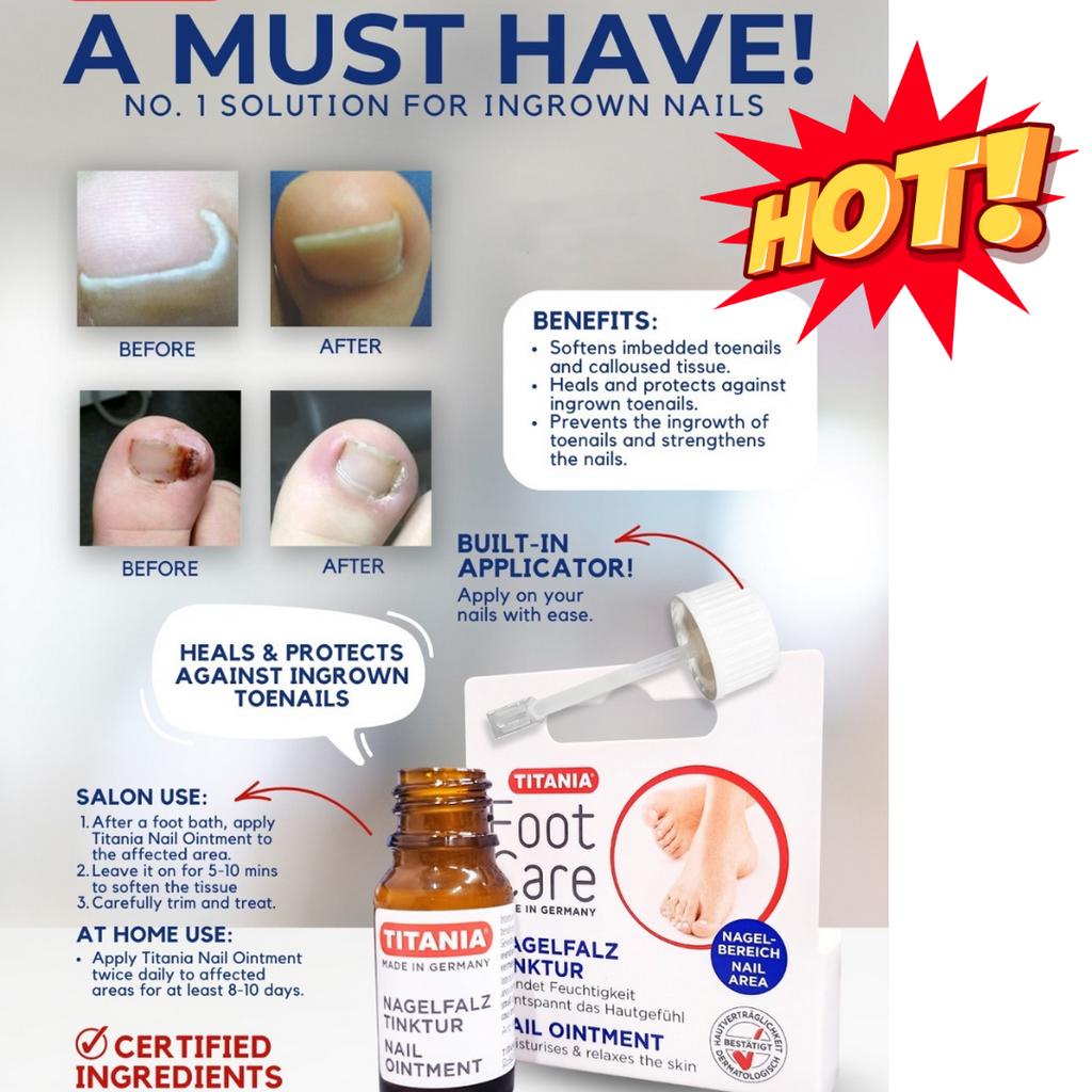 Titania Nail Ointment Ingrown Toenails Treatment Foot Feet Care Hygiene