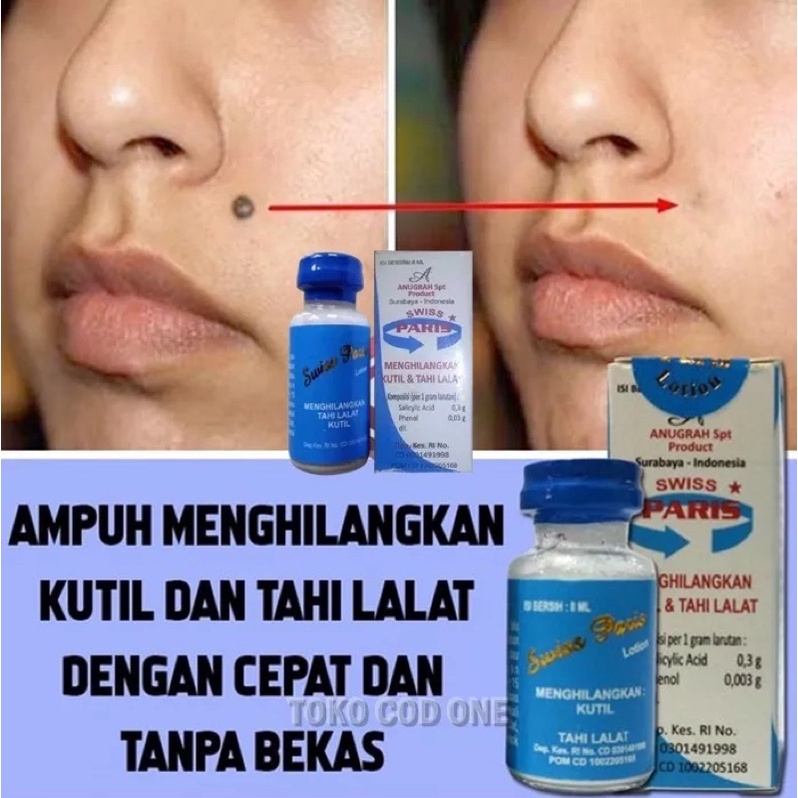 Swiss paris lotion obat penghilang kutil dan obat tahi lalat 蝦皮購物