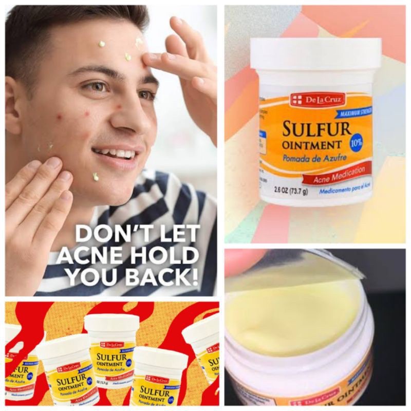 KEM DÀNH CHO DA MỤN De La Cruz, Sulfur Ointment, Acne Medication