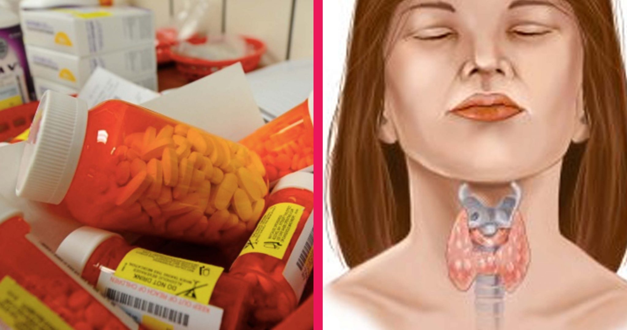 Thyroid Medication Has Been Recalled After Manufacturing Company Fails