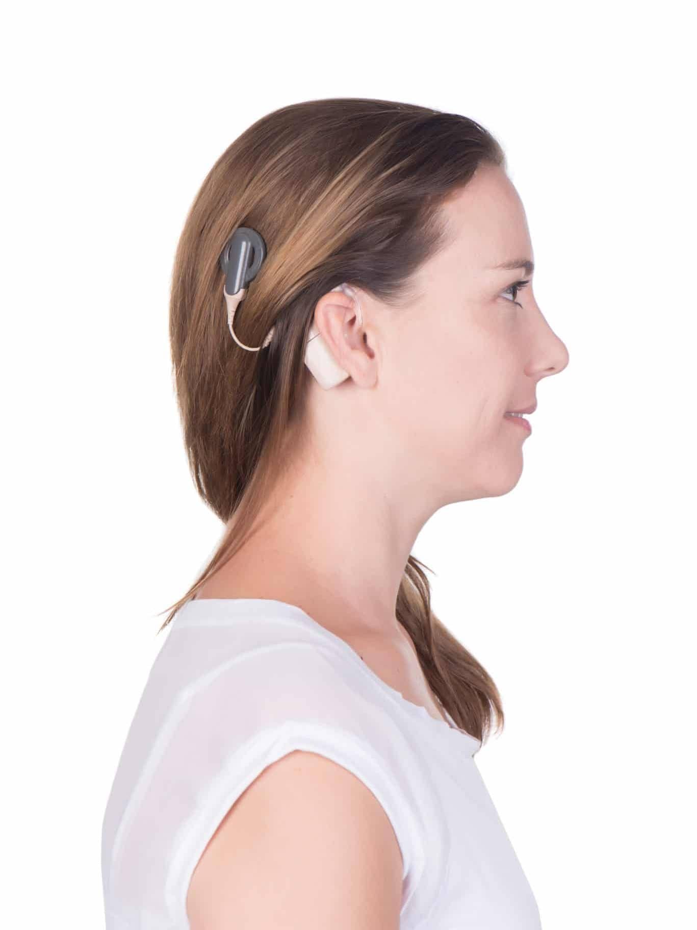 Implantable Hearing Devices Advantage ENT & Audiology
