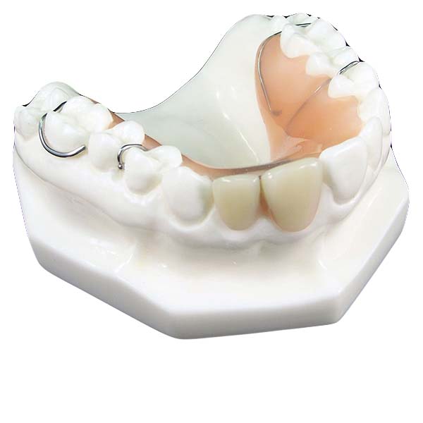 Flipper 2 trans Dental Prosthetic Services