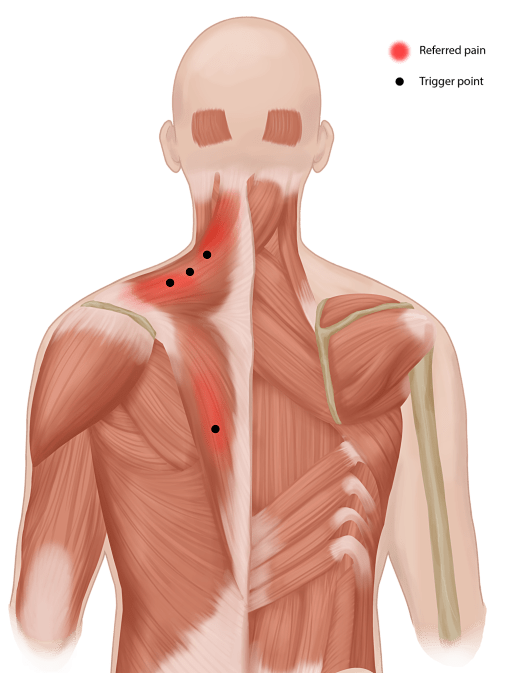 Myofascial Physiotherapy Perth Dr7 Physiotherapy Podiatry