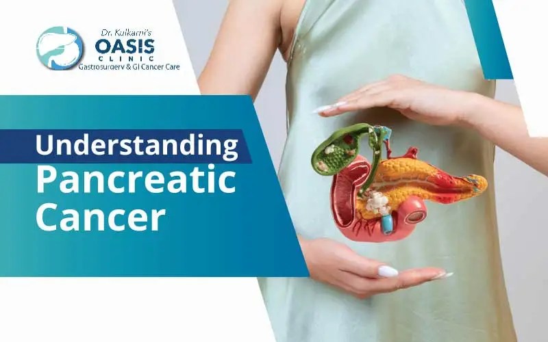 Understanding of Pancreatic Cancer