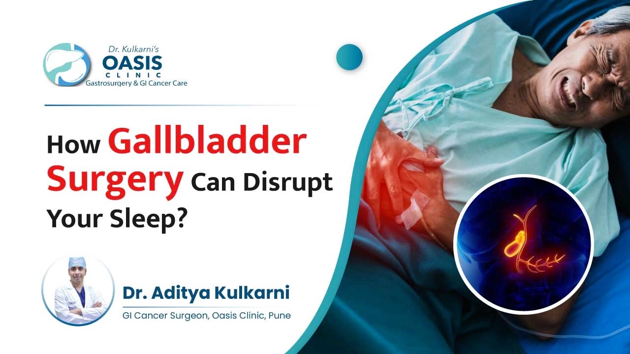 How Gallbladder Surgery Can Disrupt Your Sleep
