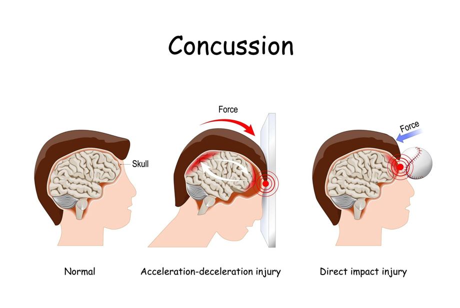 Sports Injuries Specialist Cycling Injury Treatment Mumbai