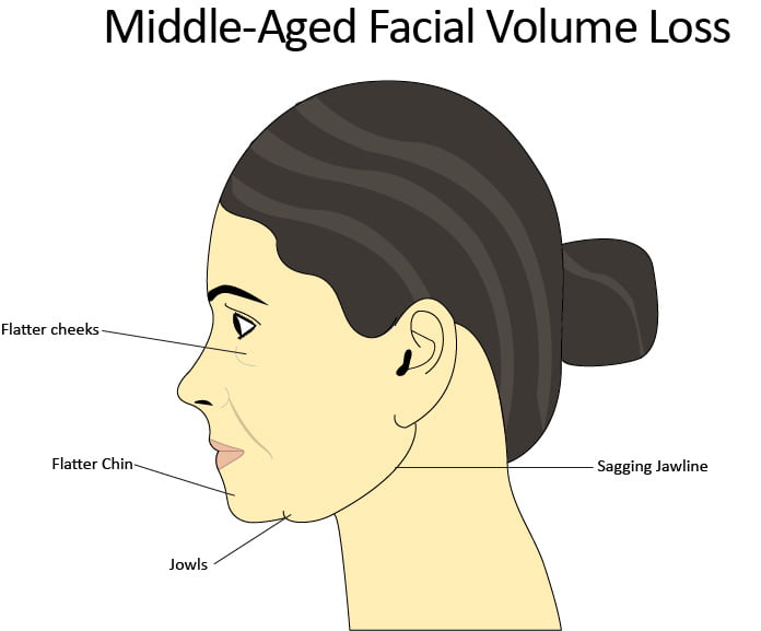 Almost everyone develops at least minor jowls as they age and their skin. Botox For Jowls Non Surgical Jowl Lift Dr Aesthetica