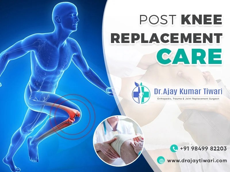 Restrictions and activity expectations after knee replacement