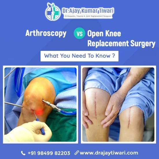 How Long Does Knee Replacement Surgery Take