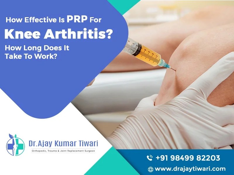 How Effective is PRP for Knee arthritis? How long does it take to work