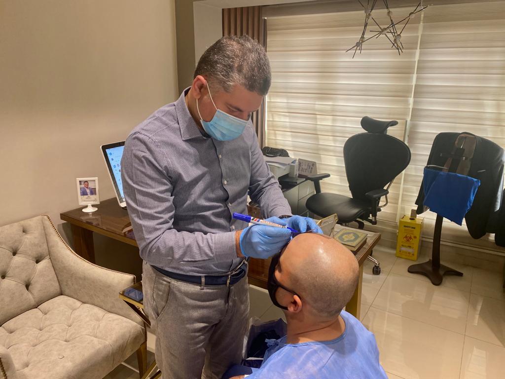 Is hair transplant safe? The 5 most important factors for choosing
