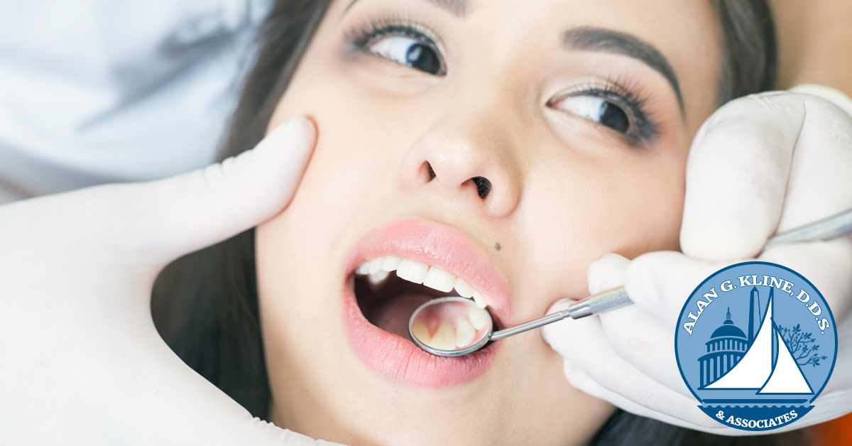 When You Have an Abscessed Tooth Dr. Alan G. Kline Maryland