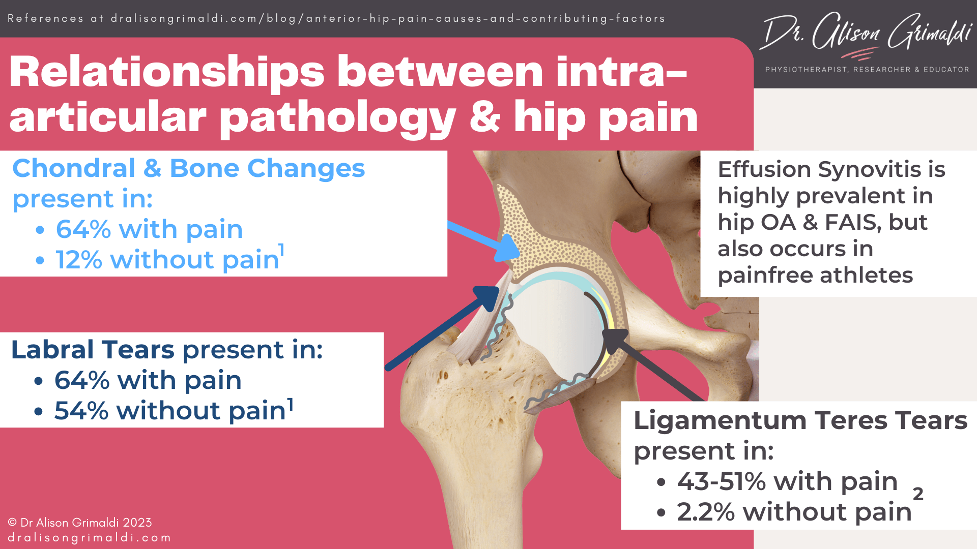 Anterior Hip Pain Causes and contributing factors Find out more